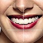 Estetica Dental 1